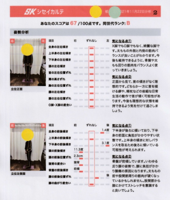 比較機能で施術効果を数値化